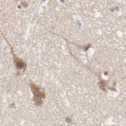 Invitrogen TCP-1 epsilon Polyclonal Antibody 100 &mu;L; Unconjugated:Antibodies,
