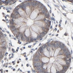 Invitrogen TCP-1 epsilon Polyclonal Antibody 100 &mu;L; Unconjugated:Antibodies,