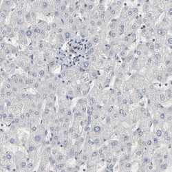 Invitrogen TCP-1 epsilon Polyclonal Antibody 100 &mu;L; Unconjugated:Antibodies,