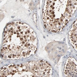 Invitrogen TCP-1 epsilon Polyclonal Antibody 100 &mu;L; Unconjugated:Antibodies,