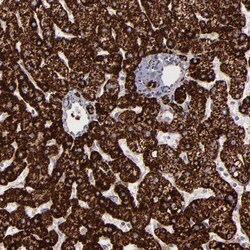 Invitrogen Monoamine Oxidase B Polyclonal Antibody 100 &mu;L; Unconjugated:Antibodies,
