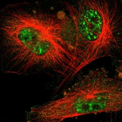 Invitrogen Cdc34 Polyclonal Antibody 100 &mu;L; Unconjugated:Antibodies,