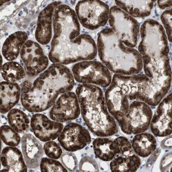 Invitrogen Cdc34 Polyclonal Antibody 100 &mu;L; Unconjugated:Antibodies,