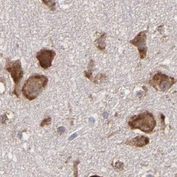 Invitrogen SND1 Polyclonal Antibody 100 &mu;L; Unconjugated:Antibodies,
