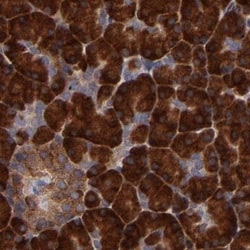 Invitrogen SND1 Polyclonal Antibody 100 &mu;L; Unconjugated:Antibodies,