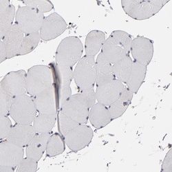 Invitrogen SND1 Polyclonal Antibody 100 &mu;L; Unconjugated:Antibodies,