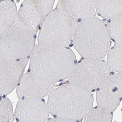 Invitrogen SND1 Polyclonal Antibody 100 &mu;L; Unconjugated:Antibodies,