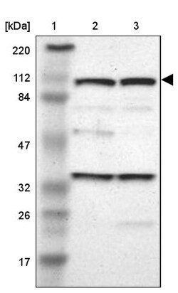 Invitrogen SND1 Polyclonal Antibody 100 &mu;L; Unconjugated:Antibodies,