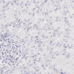 Invitrogen IRF8 Polyclonal Antibody 100 &mu;L; Unconjugated:Antibodies,