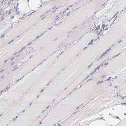Invitrogen IRF8 Polyclonal Antibody 100 &mu;L; Unconjugated:Antibodies,