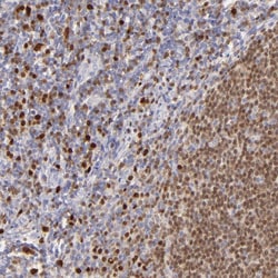 Invitrogen IRF8 Polyclonal Antibody 100 &mu;L; Unconjugated:Antibodies,