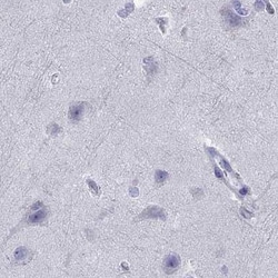 Invitrogen SERPINA3 Polyclonal Antibody 100 &mu;L; Unconjugated:Antibodies,