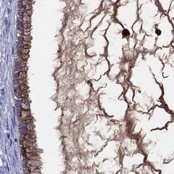 Invitrogen SERPINA3 Polyclonal Antibody 100 &mu;L; Unconjugated:Antibodies,
