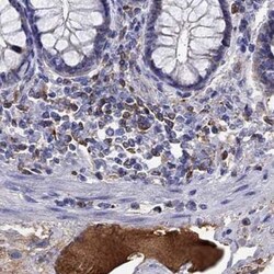 Invitrogen SERPINA3 Polyclonal Antibody 100 &mu;L; Unconjugated:Antibodies,