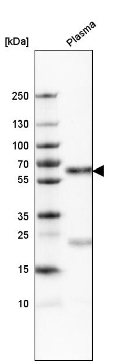 Invitrogen SERPINA3 Polyclonal Antibody 100 &mu;L; Unconjugated:Antibodies,