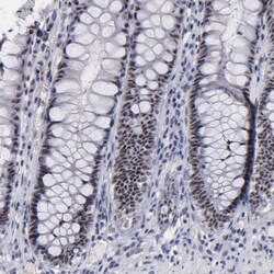 Invitrogen c-Raf Polyclonal Antibody 100 &mu;L | Buy Online | Invitrogen&trade; | Fisher Scientific