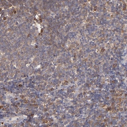 Invitrogen IkB epsilon Polyclonal Antibody 100 &mu;L; Unconjugated:Antibodies,