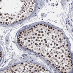 Invitrogen SSRP1 Polyclonal Antibody 100 &mu;L; Unconjugated:Antibodies,
