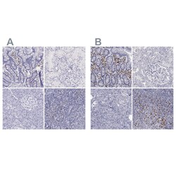 Invitrogen IRF4 Polyclonal Antibody 100 &mu;L | Buy Online | Invitrogen&trade; | Fisher Scientific