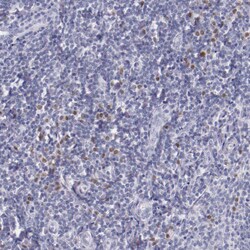 Invitrogen IRF4 Polyclonal Antibody 100 &mu;L | Buy Online | Invitrogen&trade; | Fisher Scientific