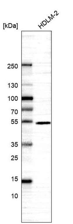 Invitrogen IRF4 Polyclonal Antibody 100 &mu;L | Buy Online | Invitrogen&trade; | Fisher Scientific