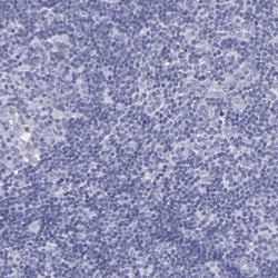 Invitrogen&trade;&nbsp;Thyroglobulin Polyclonal Antibody