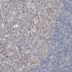 Invitrogen UQCRC1 Polyclonal Antibody 100 &mu;L; Unconjugated:Antibodies,