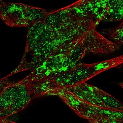 Invitrogen RSK4 Polyclonal Antibody 100 &mu;L; Unconjugated:Antibodies,