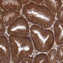 Invitrogen RSK4 Polyclonal Antibody 100 &mu;L; Unconjugated:Antibodies,