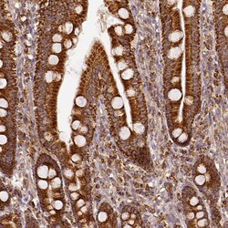 Invitrogen SDHB Polyclonal Antibody 100 &mu;L; Unconjugated:Antibodies,