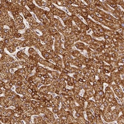 Invitrogen SDHB Polyclonal Antibody 100 &mu;L; Unconjugated:Antibodies,