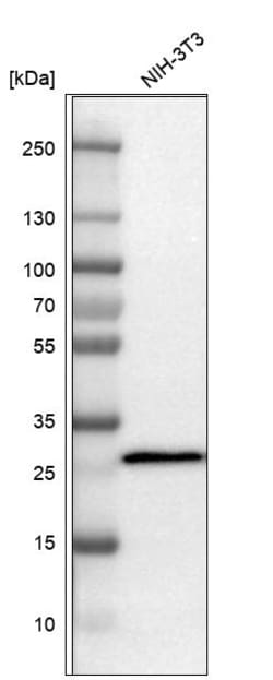 Invitrogen SDHB Polyclonal Antibody 100 &mu;L; Unconjugated:Antibodies,