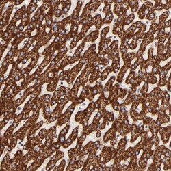 Invitrogen ECH1 Polyclonal Antibody 100 &mu;L; Unconjugated:Antibodies,