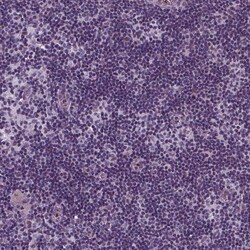 Invitrogen p57 Kip2 Polyclonal Antibody 100 &mu;L; Unconjugated:Antibodies,