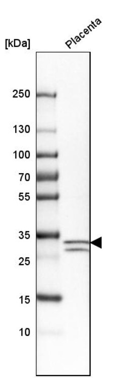 Invitrogen p57 Kip2 Polyclonal Antibody 100 &mu;L; Unconjugated:Antibodies,