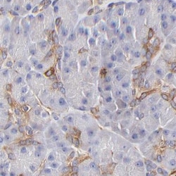 Invitrogen Filamin A Polyclonal Antibody 100 &mu;L; Unconjugated:Antibodies,