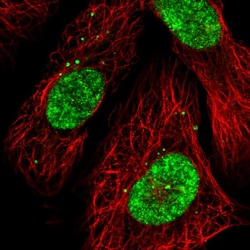 Invitrogen CECR2 Polyclonal Antibody 100 &mu;L; Unconjugated:Antibodies,