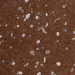 Invitrogen CADM3 Polyclonal Antibody 100 &mu;L; Unconjugated:Antibodies,