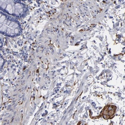 Invitrogen CADM3 Polyclonal Antibody 100 &mu;L; Unconjugated:Antibodies,