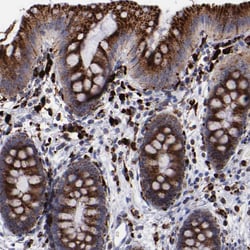 Invitrogen Cathepsin S Polyclonal Antibody 100 &mu;L; Unconjugated:Antibodies,