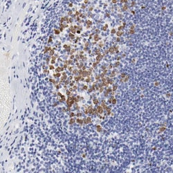Invitrogen NCAPH Polyclonal Antibody 100 &mu;L; Unconjugated:Antibodies,