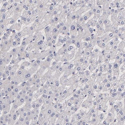 Invitrogen GNAZ Polyclonal Antibody 100 &mu;L; Unconjugated:Antibodies,