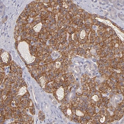 Invitrogen GNAZ Polyclonal Antibody 100 &mu;L; Unconjugated:Antibodies,