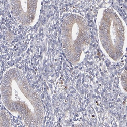 Invitrogen TMX Polyclonal Antibody 100 &mu;L; Unconjugated:Antibodies,