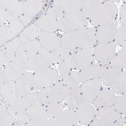 Invitrogen TMX Polyclonal Antibody 100 &mu;L; Unconjugated:Antibodies,