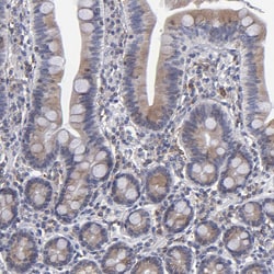 Invitrogen TMX Polyclonal Antibody 100 &mu;L; Unconjugated:Antibodies,