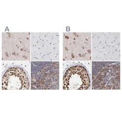 Invitrogen TCP-1 beta Polyclonal Antibody 100 &mu;L | Buy Online | Invitrogen&trade; | Fisher Scientific