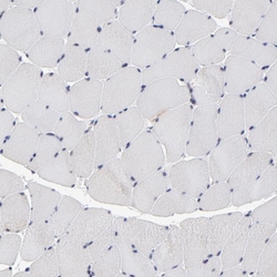 Invitrogen TCP-1 beta Polyclonal Antibody 100 &mu;L | Buy Online | Invitrogen&trade; | Fisher Scientific