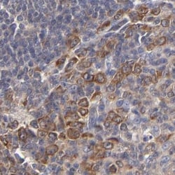Invitrogen TCP-1 beta Polyclonal Antibody 100 &mu;L | Buy Online | Invitrogen&trade; | Fisher Scientific