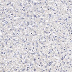 Invitrogen PTK7 Polyclonal Antibody 100 &mu;L | Buy Online | Invitrogen&trade; | Fisher Scientific